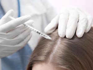 هزینه کربوکسی تراپی مو در کلینیک تندیس