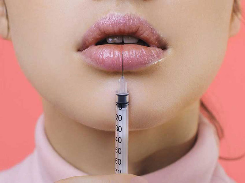 مراقبت های بعد از تزریق ژل لب - کلینیک تندیس