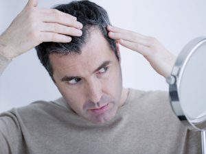 درمان ریزش مو پس از کرونا - کلینیک تندیس