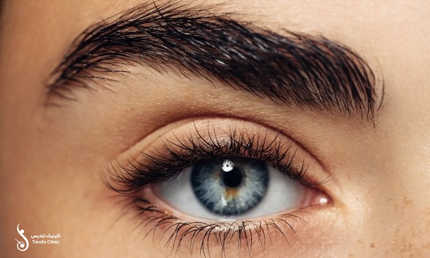 نمونه کاشت ابرو fit یک خانم زیباجو