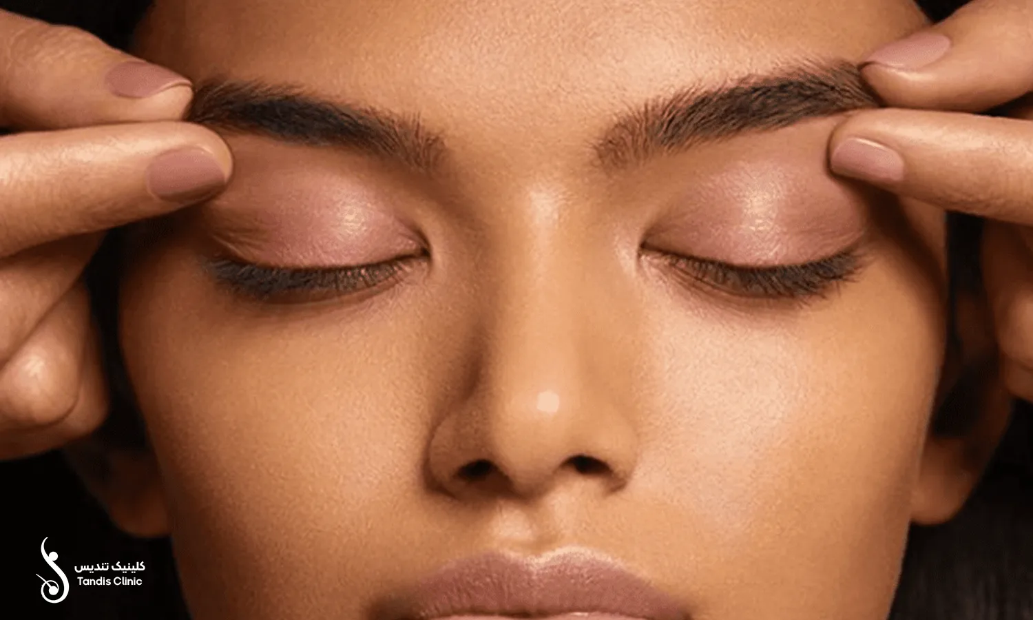 کاشت ابرو به روش fit برای یک دختر خانم