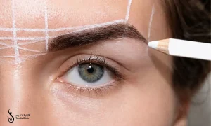 کاشت ابرو به روش fit