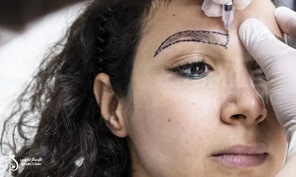 پزشکی که در حال انجام خط کشی های قبل از کاشت ابرو دخترانه است