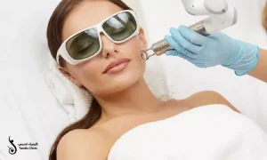 لیزر co2 فرکشنال روی صورت که یک خانم روی تخت خوابیده