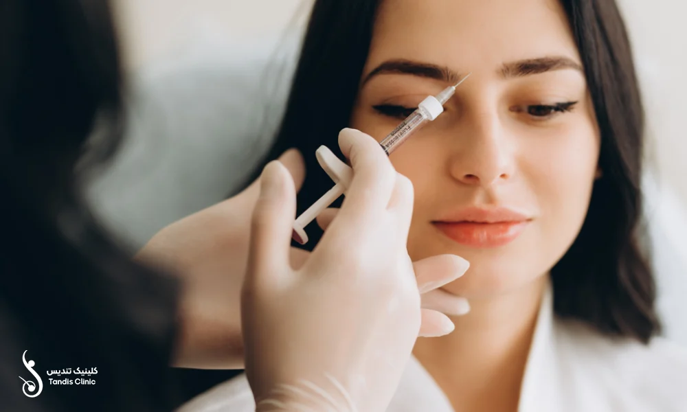تزریق مزوژل جالپرو بین ابروهای یک خانم