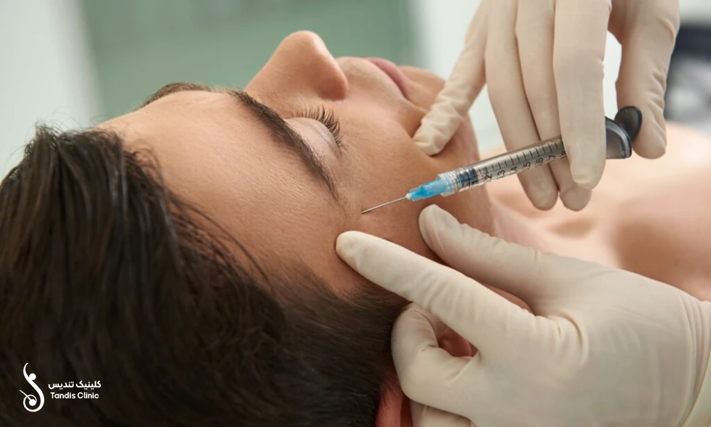 انجام تزریق فیلر زیر چشم برای آقایان