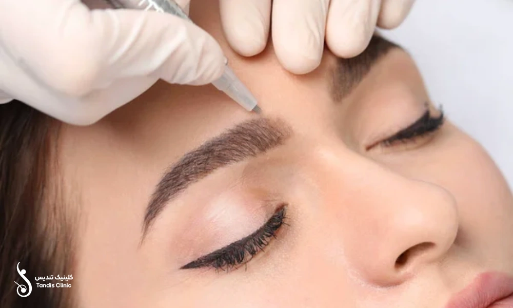 روش میکروبلیدینگ ابرو | مقایسه میکروبلیدینگ با کاشت ابرو