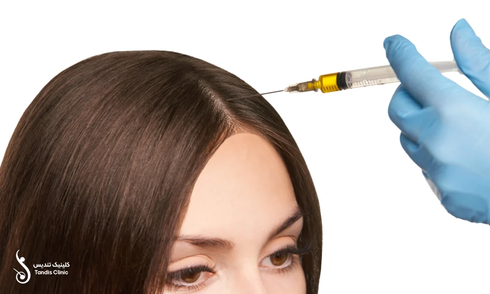 تزریق مزوتراپی به سر یک خانم زیباجو توسط متخصص زیبایی