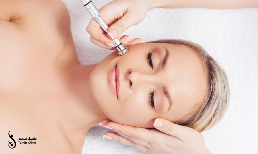 میکرودرم گونه یک خانم که روی تخت دراز کشیده