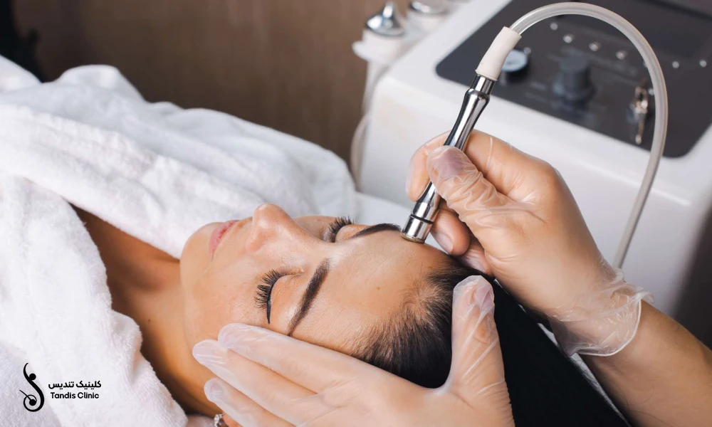 میکرودرم برای جوانسازی پوست یک زیباجو