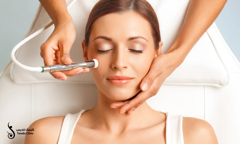 خانمی در حال انجام میکرودرم بر روی پوست خود