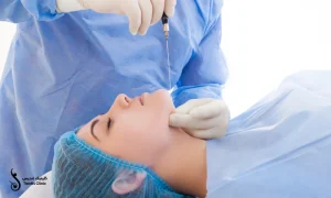 انجام عمل لیپوساکشن غبغب توسط پزشک