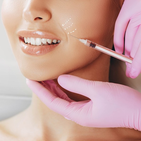 فیلر خط خنده چیست؛ مراقبت، ماندگاری و هزینه