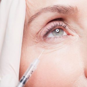 بوتاکس زیرچشم چیست؛ عوارض، نقاط تزریق، مدت ماندگاری
