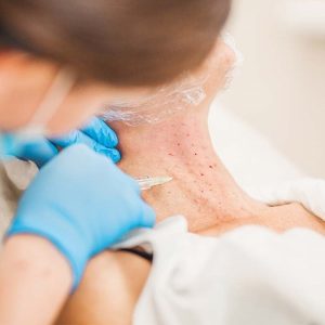 بوتاکس گردن چیست؛ کاربرد، نقاط تزریق، عوارض و ماندگاری