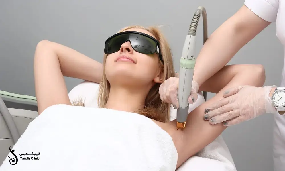 خانمی که برای انجام لیزر موهای زائد زیر بغل خود به پزشک مراجعه کرده