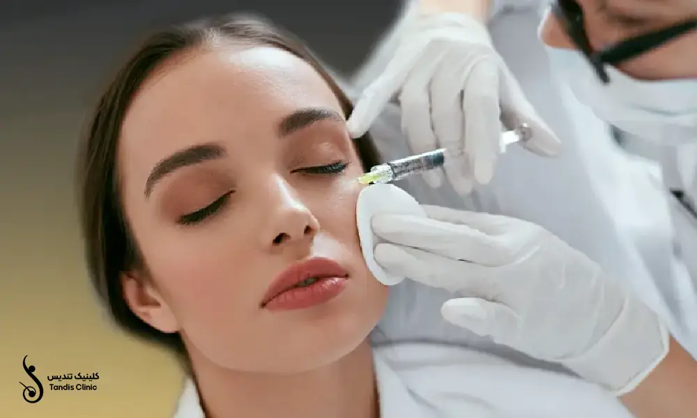 تزریق مزوژل پروفایلو به گونه ی خانمی با موهای مشکی