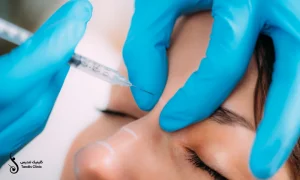 تزریق بوتاکس به بالا بینی