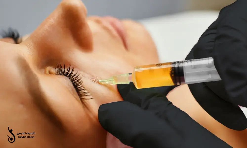 انجام پی آر پی صورت برای مراجعه کننده