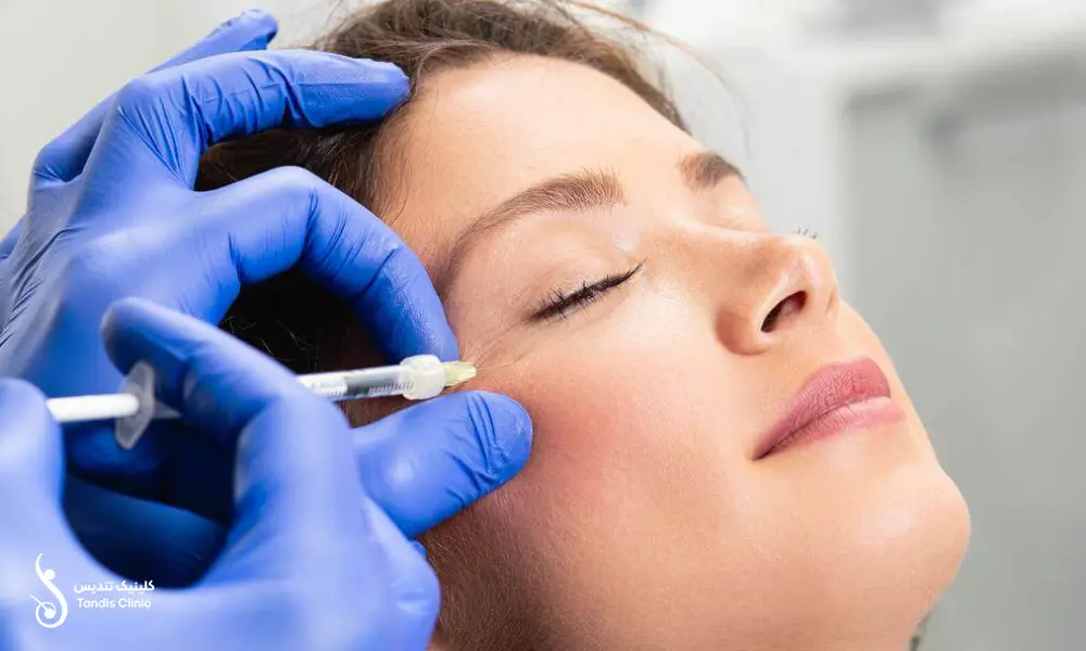 انجام پی آر پی صورت برای خانمی که لبخند بر لب دارد