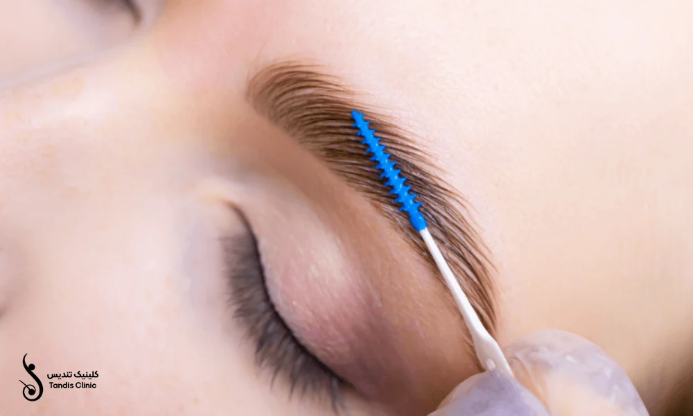 شانه کشی ابرو پس از کاشت | کاشت ابرو به روش FUT