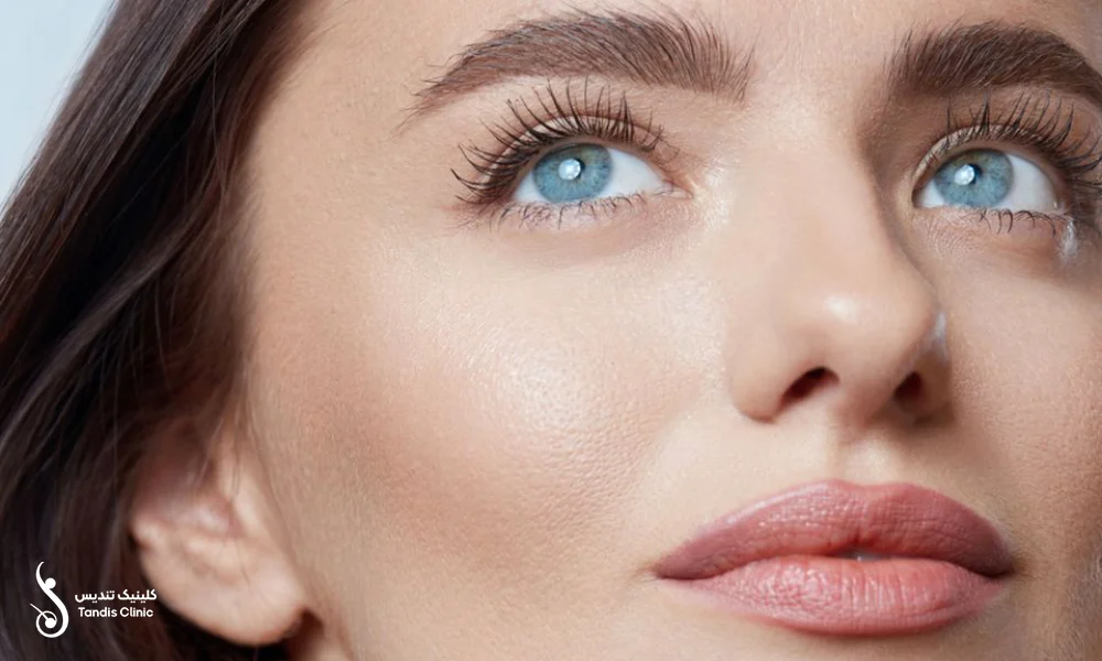 دختری که کاشت ابرو به روش SUT انجام داده