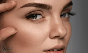دختری زیبا که کاشت ابرو به روش FUE انجام داده است