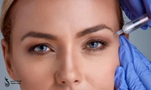 خانمی با چشم های رنگی که پزشک در حال تزریق بوتاکس برای او است | بوتاکس چشم گربه ای