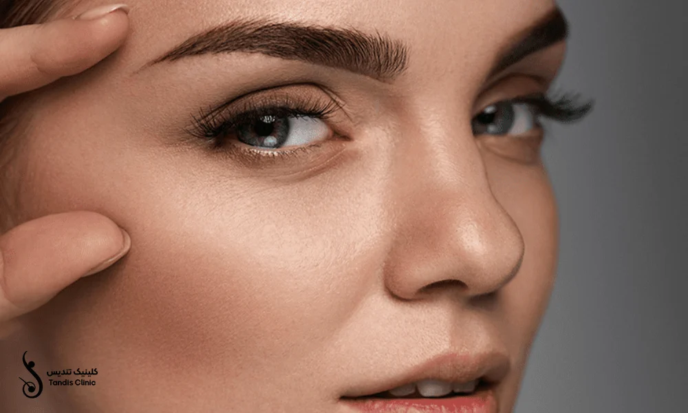 دختری زیبا که کاشت ابرو به روش FUE انجام داده است