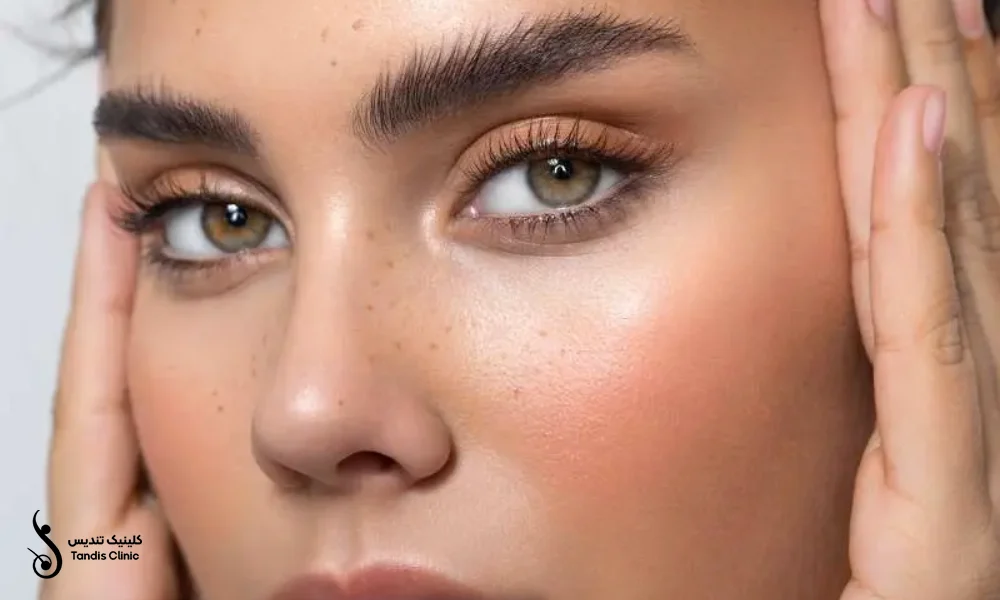 کاشت ابرو به روش SUT و تاثیر آن در زیبایی دختران