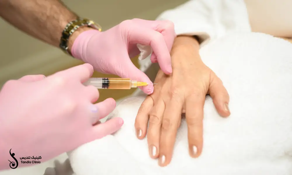 پزشکی با دستکش های صورتی که در حال تزریق پی آر پی دست برای بیمار میباشد