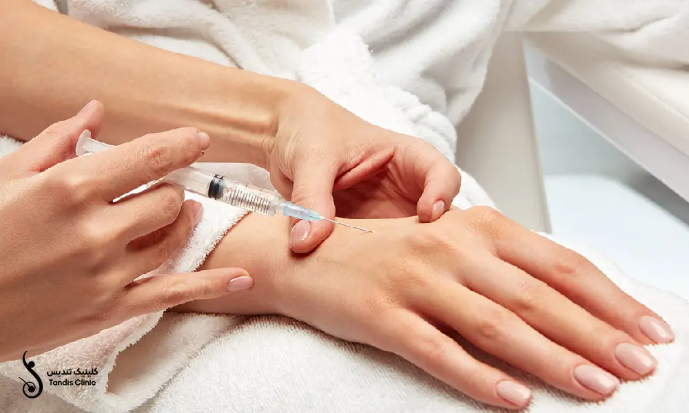 انجام پی آر پی دست به منظور جوانسازی دست های یک خانم