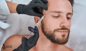 تزریق فیلر شقیقه برای یک اقا