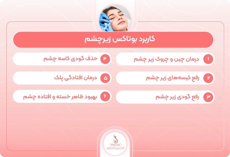 اینفوگرافی-کاربرد-بوتاکس-زیر-چشم