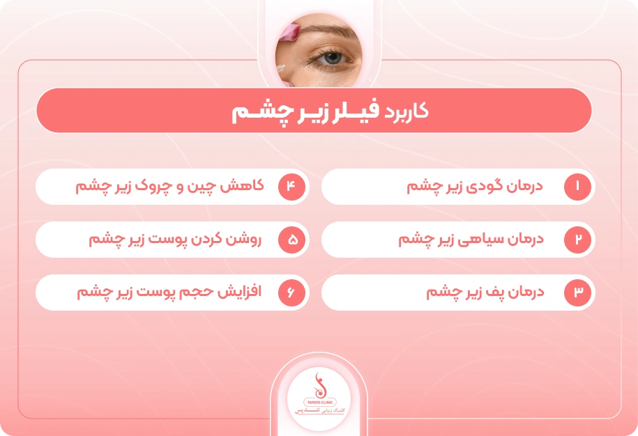 اینفوگرافی کاربردهای فیلر زیر چشم